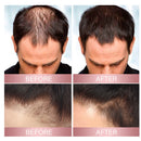 EELHOE Rice Hair Spray - Strong and Refined Hair, Repairs Hair Follicles and Hair Roots, Prevents Hair Loss and Makes Hair Thick